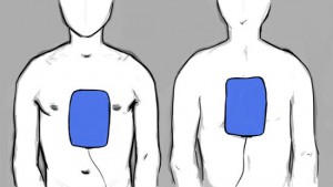 550px-ems_pediatric_aed_pad_placement.jpg